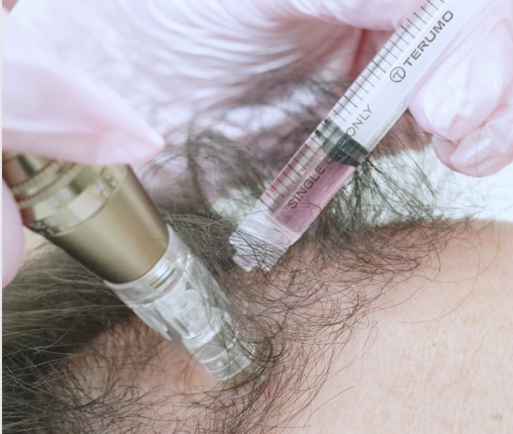 Why More Men Are Choosing Aesthetic Treatments